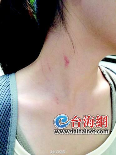 起因是攬客不成起爭執 (1)